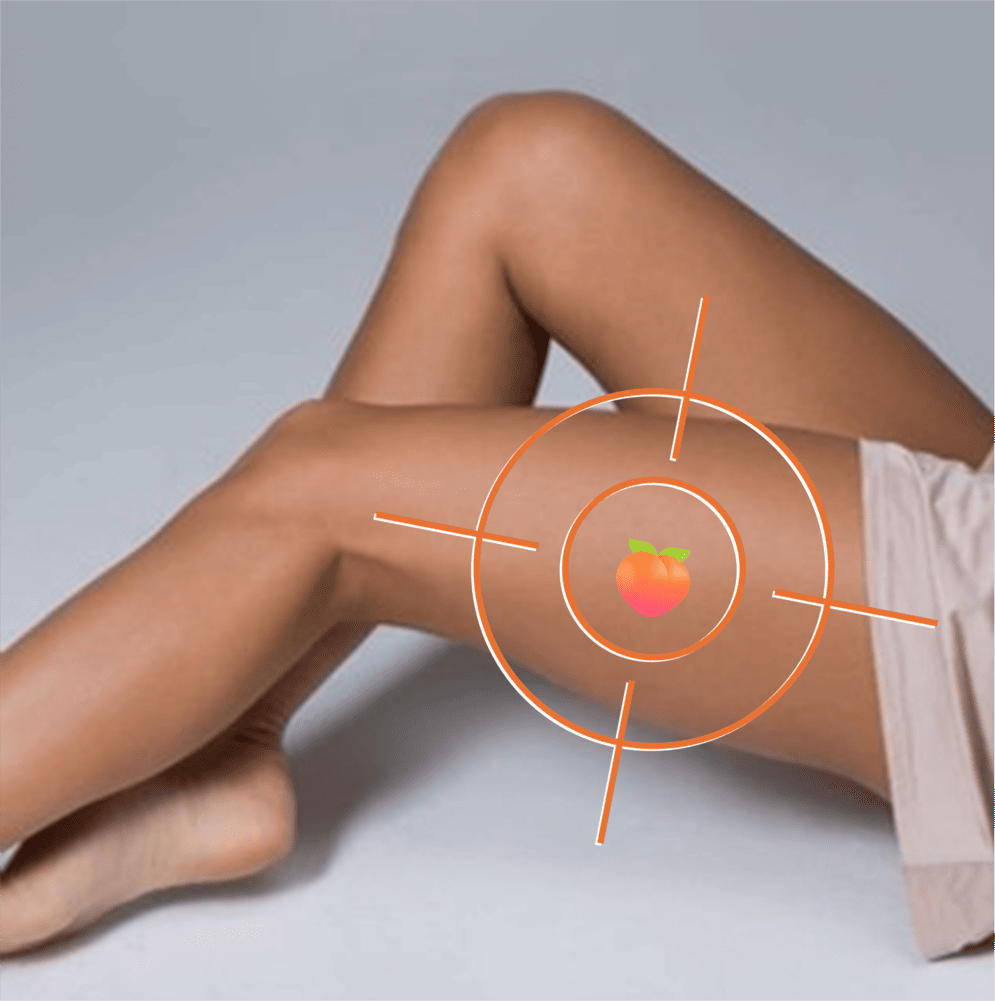 Cellulite des cuisses