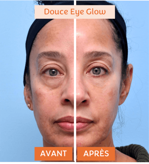 douce-eye-glow-6