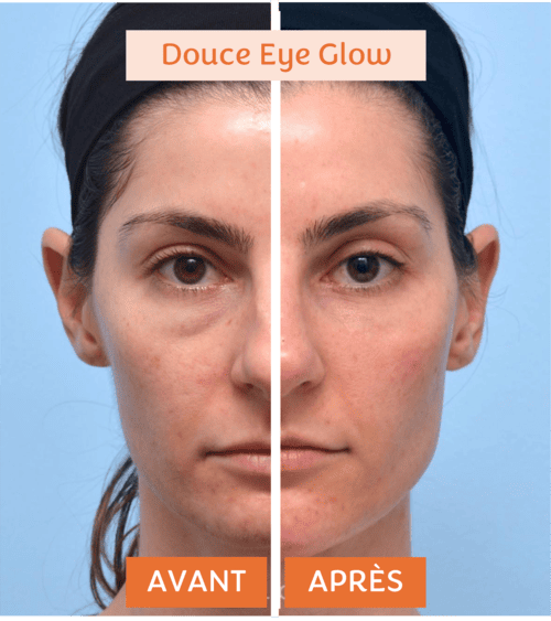 douce-eye-glow-7