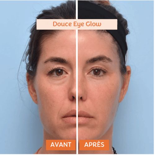 douce-eye-glow-8